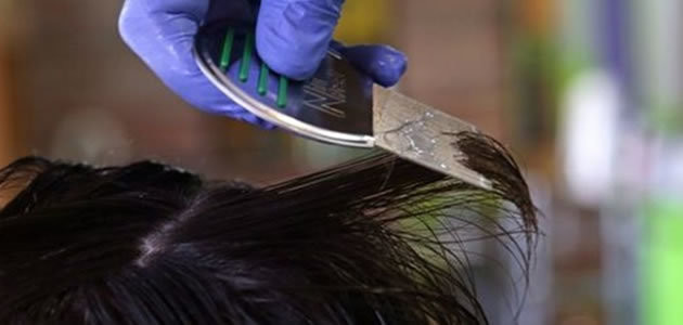 Selfies aumentam o risco de contaminação por piolhos