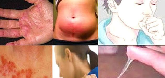 14 sinais que você pode estar com câncer e não sabe