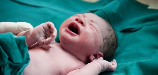Bebês que nascem de cesárea tem mais chances de serem obesos