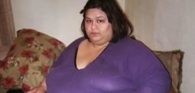 Mulher mais pesada do mundo perde 400 kg