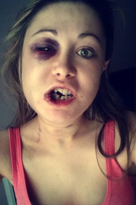 Jovem relatou agressão em rede social (Crédito: Reprodução)