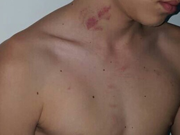 Jovem foi agredido por policial (Crédito: Divulgação)