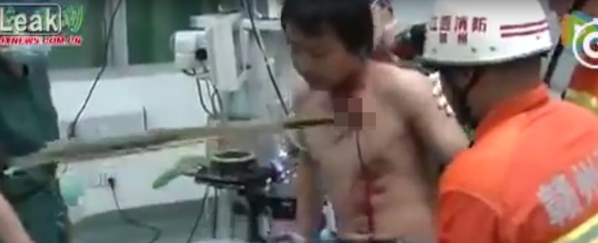 Homem sofre acidente e fica com bambu atravessado no peito