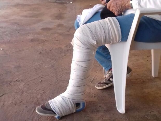 Idosa com perna enfaixada (Crédito: Reprodução)