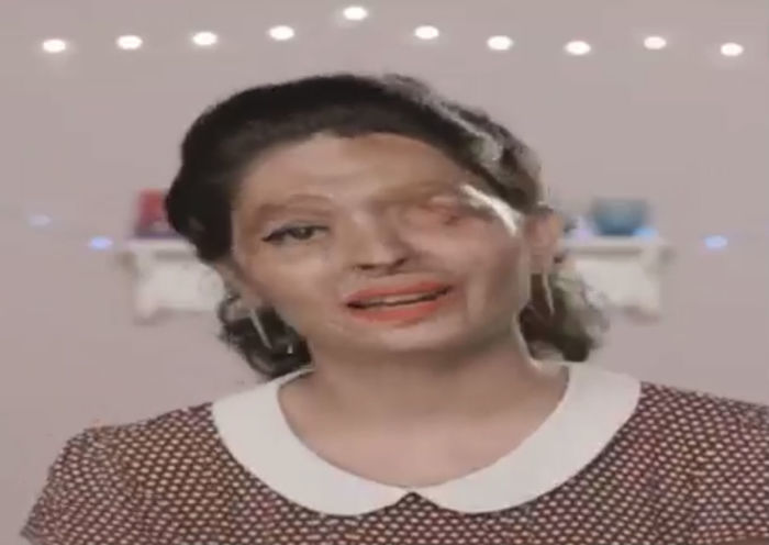 Reshma Qureshi perdeu um olho no ataque (Crédito: Reprodução)