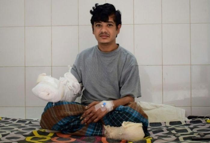 Homem-árvore passa por 16 cirurgias