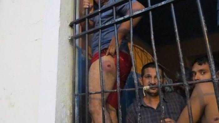 Preso mostra perna machucada durante chacina