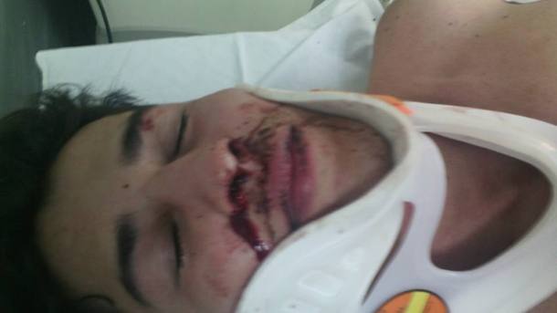 Gerente de boate LGBT é agredido ao pedir ajuda após assalto