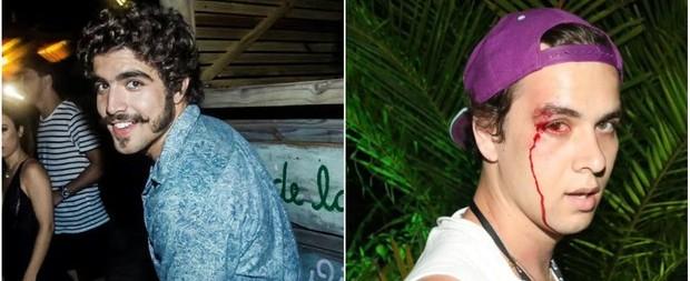 Caio Castro fala sobre agressão à fotógrafo: “Perdi a cabeça”