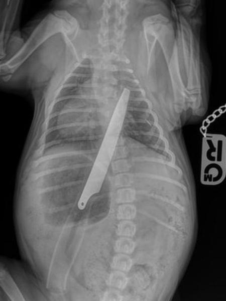 Faca ficou alojada entre o intestino e a garganta