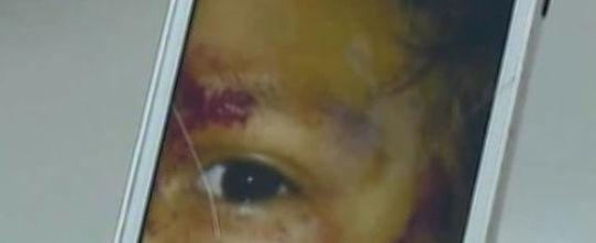 Mãe é espancada após permitir agressões contra os filho de 4 anos