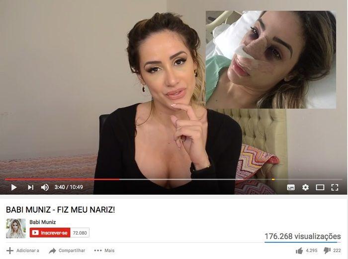 Babi Muniz associa recuperação com 'fusca batido' (Crédito: Reprodução)