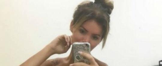 Thalita Zampirolli usa fita adesiva para se bronzear e é elogiada