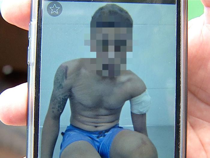 O adolescente passou por cirurgia (Crédito: Reprodução)
