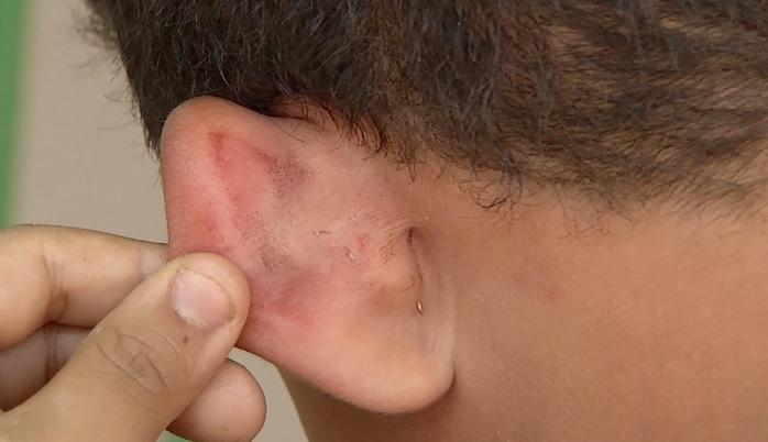 Três crianças são espancadas por policial na z. Sul de Teresina (Crédito: Reprodução/AGORA)