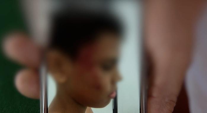 Três crianças são espancadas por policial na z. Sul de Teresina (Crédito: Reprodução/AGORA)