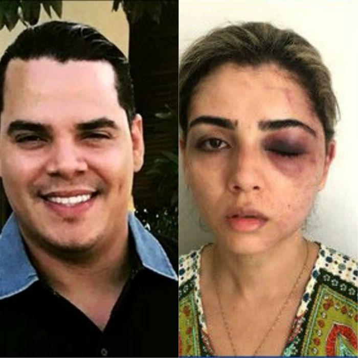 Empresário acusado de agredir a ex-mulher no Maranhão (Crédito: TV Mirante)
