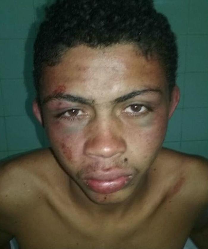 Homem sofreu várias lesões pelo corpo (Crédito: Reprodução)
