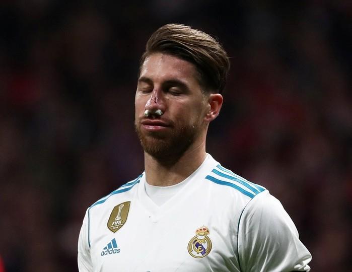 Sergio Ramos jogou alguns minutos com proteção no nariz antes de ser substituído (Crédito: : REUTERS/Juan Medina)