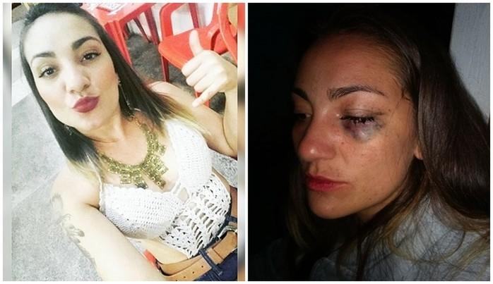 ovem publicou fotos da irmã que foi agredida pelo ex-namorado em Itapetininga (Crédito: Arquivo Pessoal)