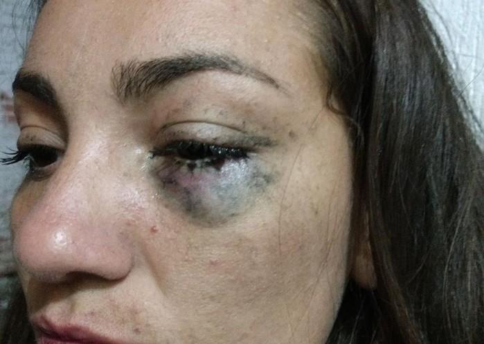 Mulher agredida (Crédito: Arquivo Pessoal)