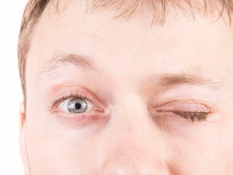 Homem perde a visão de um olho após passar por orgasmo muito forte