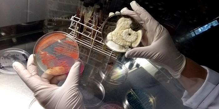 Amostras de roupas íntimas foram analisadas em pesquisa de Campinas, que constatou contaminação por fungos e bactérias