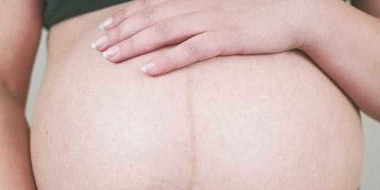 Especialistas afirmam que é possível engravidar fazendo sexo anal