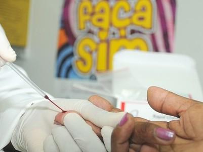 Brasil registrou 37.884 casos de HIV em 2016 com aumento de 4%