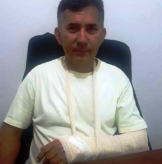 Deputado Aluísio Martins é assaltado e sofre fratura