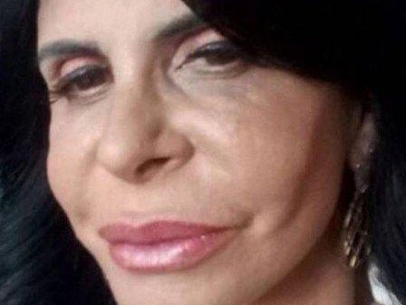 Gretchen esclarece polêmica sobre preenchimento labial: 'Só Pintei'