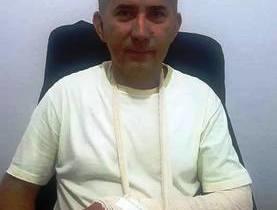 Deputado Aluísio Martins é assaltado e sofre fratura