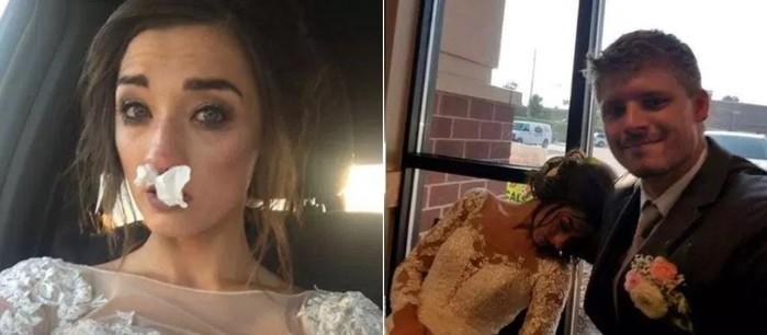 Noiva sofre reação às flores de buquê e vai parar no hospital
