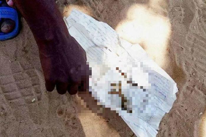 Mulher crema feto após ele nascer com aparência de sapo