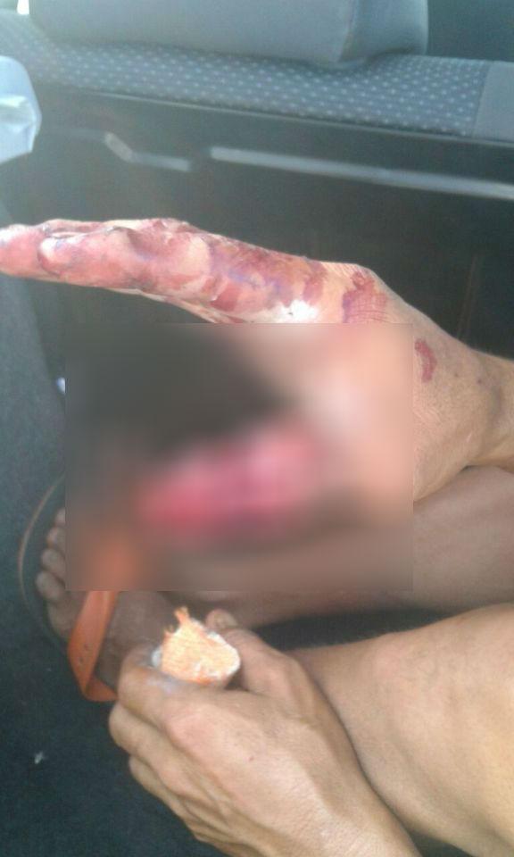 Acusado de estuprar 'garota especial'é preso e tem dedo decepado
