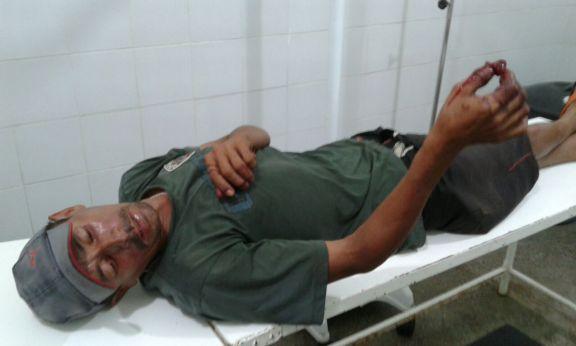 Acusado de estuprar 'garota especial'é preso e tem dedo decepado