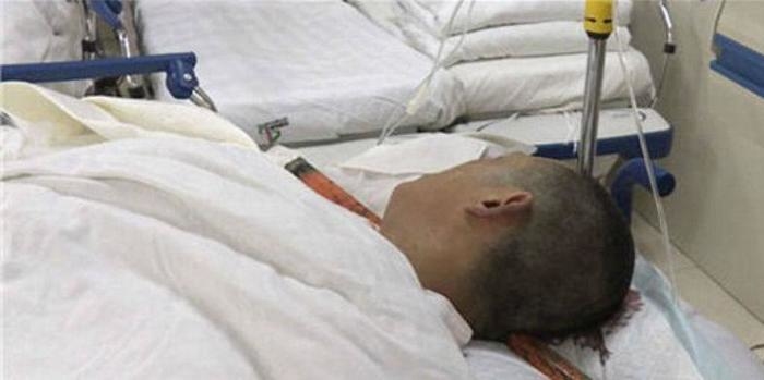 Homem sobrevive após haste de ferro de 1,5m atravessar sua cabeça