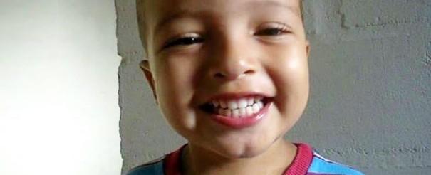 Garoto morre após ser atacado por Pitbull da família