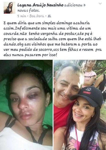 Jovem espancada pelo marido denuncia violência em rede social