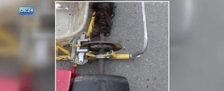 Cabelo de menina fica preso em motor e couro cabeludo é arrancado