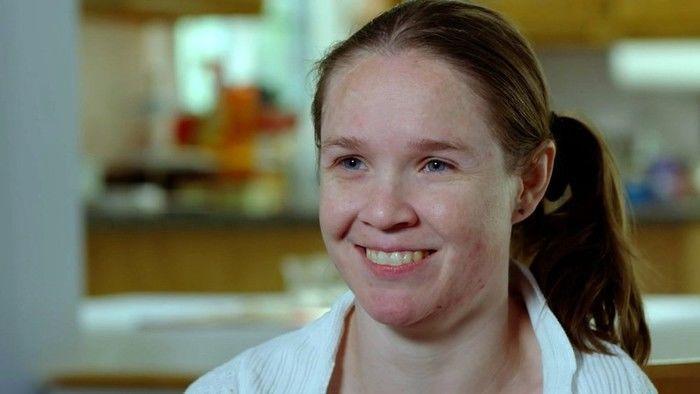 Mulher tem 'meio cérebro' para superar doença