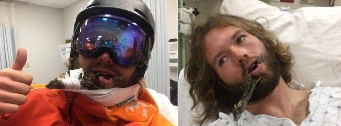 Natty em hospital após o acidente insólito (Crédito: Reprodução)