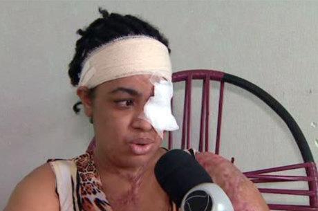 Mulher é atacada com ácido pela suposta amante do marido