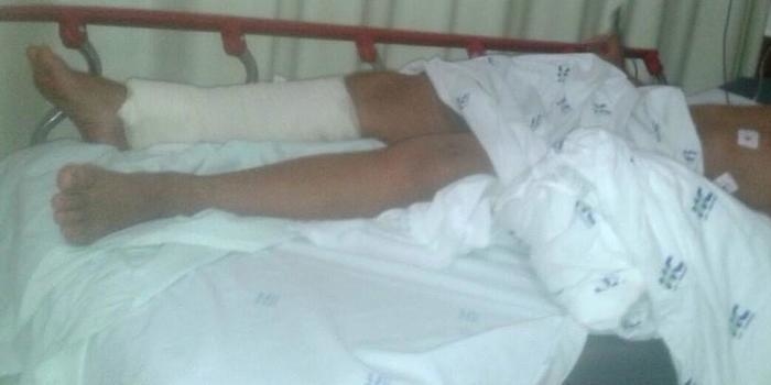 Mãe de atacado por pit bull viu "pedaço da perna na boca do cão"