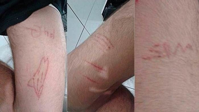 Jovem tem ataque de fúria e mãe descobre que ele jogava Baleia Azul
