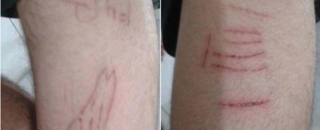 Polícia investiga Baleia Azul e caso de jovem que caiu de prédio