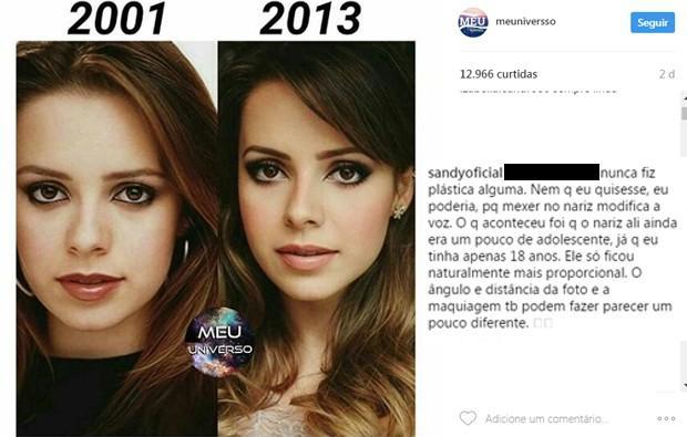 Sandy rebate comentário sobre plástica no nariz