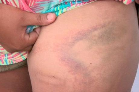 Família denuncia PMs de agressão durante festa na Bahia