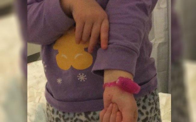 Anel peniano é encontrado por menina e “se transforma em relógio”