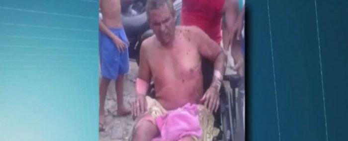 Cadeirante morre após ter 90% do corpo queimado em Fortaleza